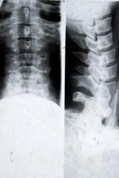 X-ray picture Stock Photos