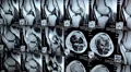 X-ray pictures in doctors office HD Footage