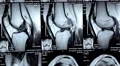 X-ray pictures in a doctors office HD Footage