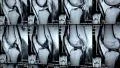 X-ray pictures in doctors room HD Footage