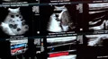 X-ray pictures HD Footage