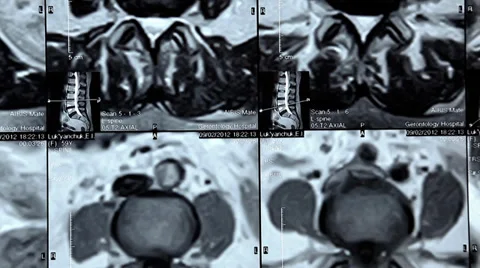 X-ray pictures Stock Footage 33577693