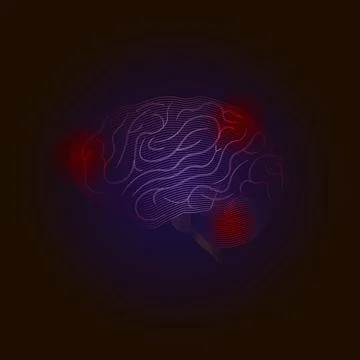 X-ray point Vector Medical illustration. Diseases of the brain with points of Stock Illustration
