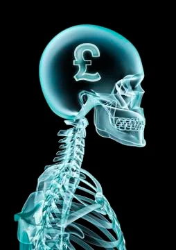 X-ray pound Stock-Illustration