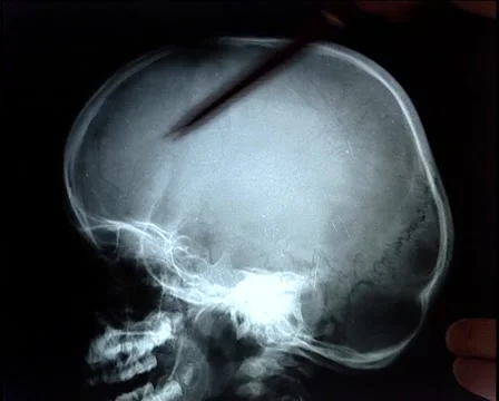 X-Ray profile Vidéo 925524