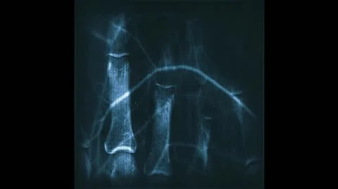 X-ray. Radiograph, roentgenogram Stock Footage 14073021