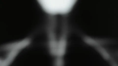X-ray radiography Stock Footage 130243730