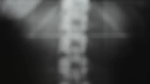 X-ray radiography Stock Footage 130243755