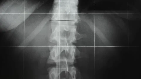 X-ray radiography Stock Footage 130243759