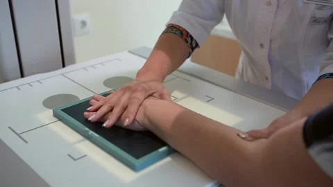 X-ray roentgen hands Video stock 168569452