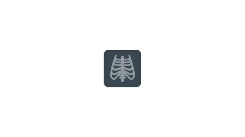 X ray roentgen icon animation for video motion graphics Stock Footage 203817023