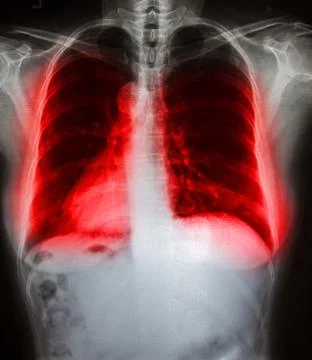 X-ray scan human Stock Photos