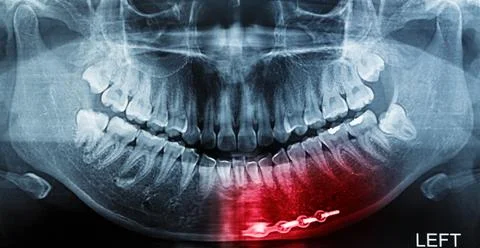 X-ray scan human Stock Photos