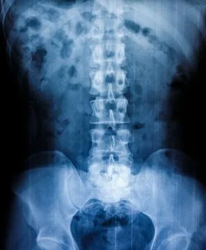 X-ray scan human Stock Photos