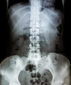 X-ray scan human Stock Photos