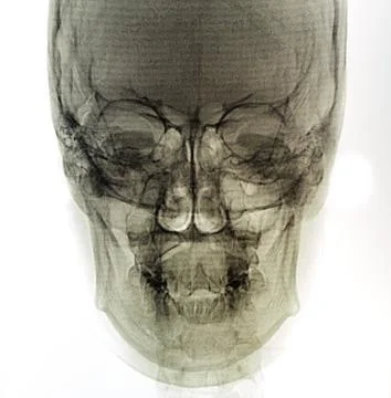 X-Ray scan human Stock Photos