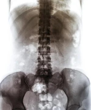 X-Ray scan human Stock Photos