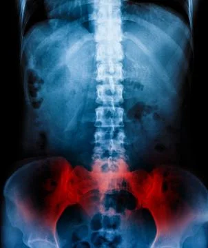 X-Ray scan human Stock Photos