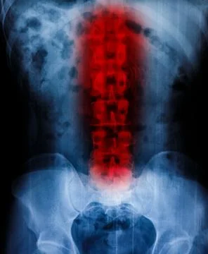 X-Ray scan human Photos