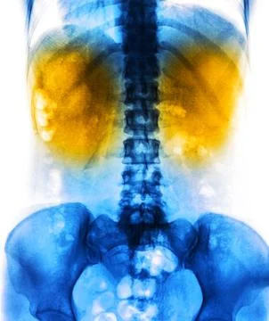 X-Ray scan human Stock Photos