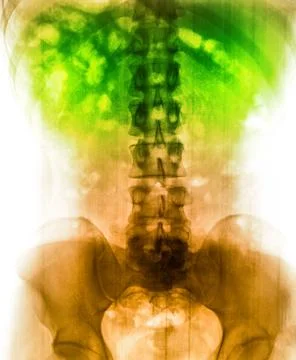 X-Ray scan human Stock Photos