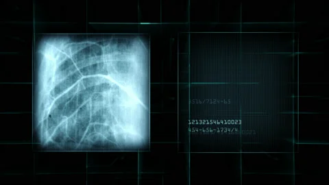 X-ray scan motion. Stock Footage 140138707