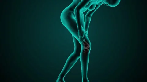 X-ray scan of a woman's knee joint Stock Footage 278538728