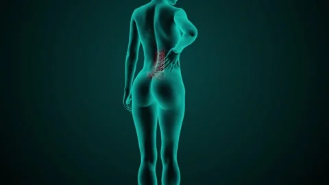 X-ray scan of a woman's Low back pain Stock Footage 279461396