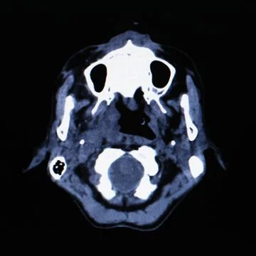 X-ray scanner of head background. Stock Photos
