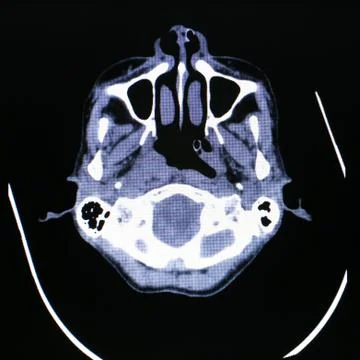X-ray scanner of head background. Stock Photos