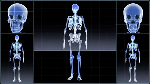 X-ray scanning Stock Footage 75167528