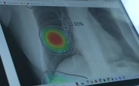 X-Ray on a Screen 2 Stock Footage 296483762