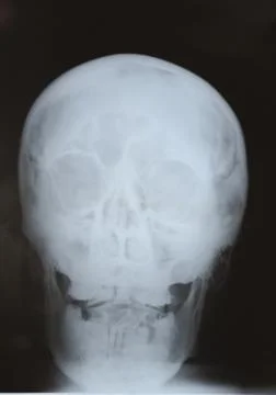 X-ray shot Stock Photos