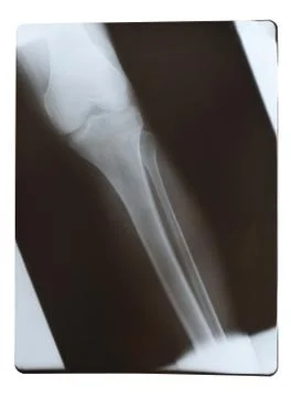 X-ray shot Stock Photos