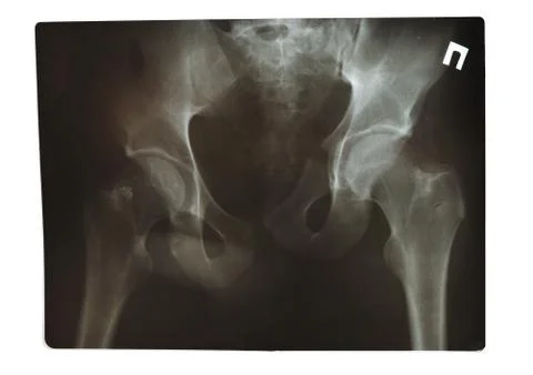 X-ray shot Stock Photos