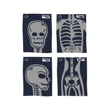X-ray shots. Stylized x-ray pictures of human chest, head in front and side view Stock Illustration