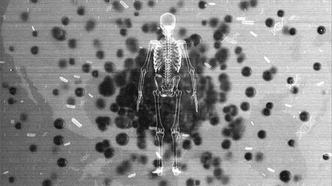X-ray Skeleton Amidst Floating Particles and Digital Elements Stock Footage 339123491