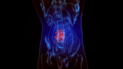 X-ray skeleton animation of lower back spine pain Stock Footage 77154997