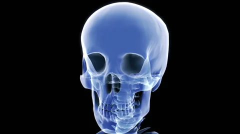 X Ray Skull Stock Footage 58243970