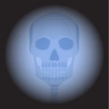 X ray skull. Stock Illustration