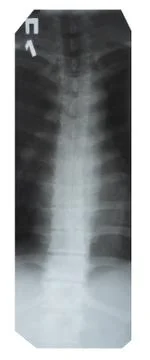 X-ray of the spine Stock Photos