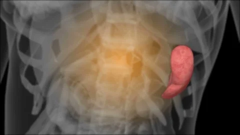 X-ray of the spleen Stock Footage 74108905