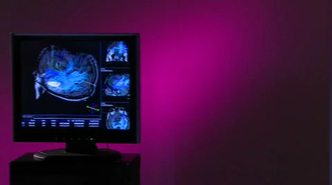 X-Ray Tech gestures toward blue brain scan2 Stock Footage 459271