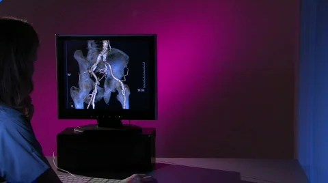 X-Ray Tech points to 3D model Stock Footage 459355