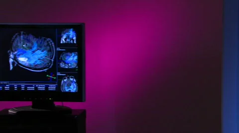X-Ray Tech views blue brain scan Stock Footage 459839