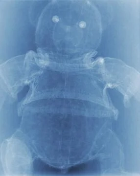 X ray teddy bear Stock Illustration