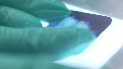 X-ray of teeth, detailed close-up. Stock Footage 143644965