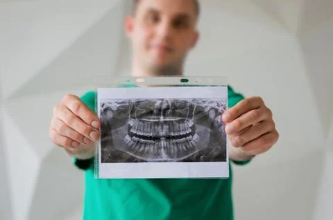 X-ray of teeth in the hands of a dentist Stock Photos