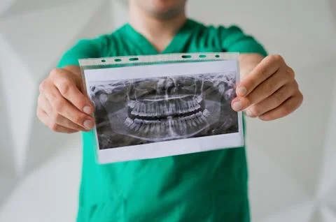 X-ray of teeth in the hands of a dentist Stock Photos