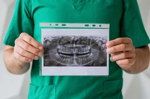 X-ray of teeth in the hands of a dentist Stock Photos